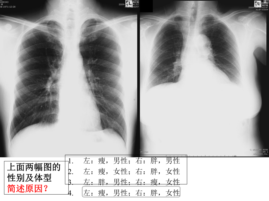 呼吸系统正常影像.ppt_第2页