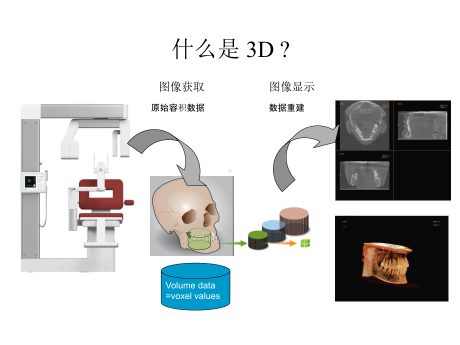 口腔锥形扫描-3D-系统-(带全景功能).ppt_第3页