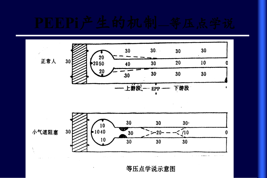 慢性阻塞性肺疾病的机械通气课件精选.ppt_第3页