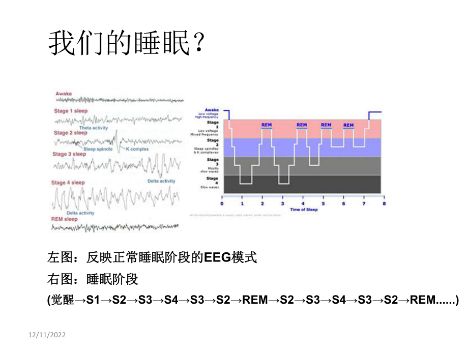 《睡眠障碍1》ppt课件-PPT精选文档.ppt_第2页