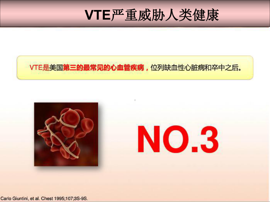 静脉血栓栓塞症的防治与建议课件.ppt_第2页