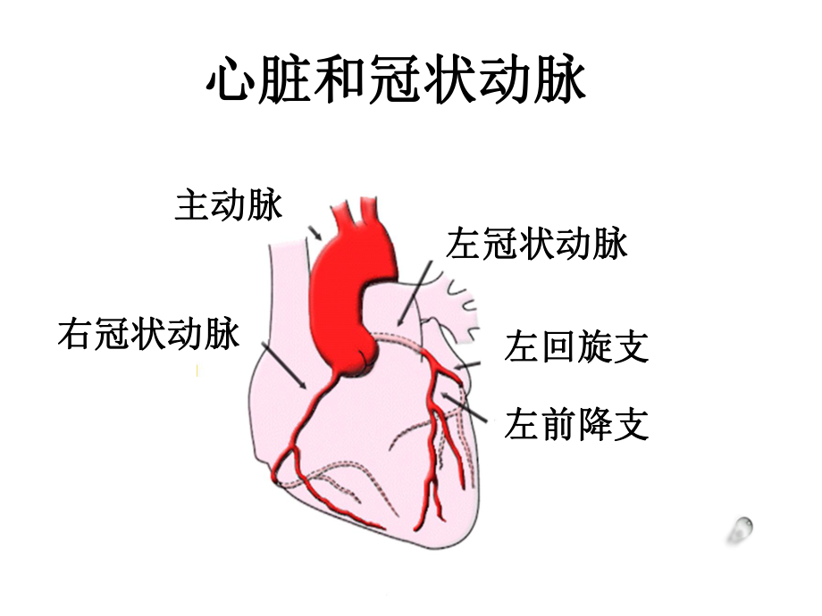 pci护理查房-课件.ppt_第3页