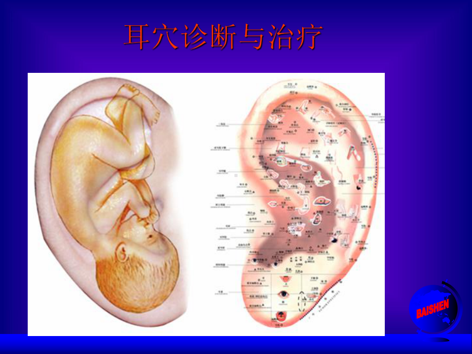 医学院耳穴诊断与治疗.ppt_第2页