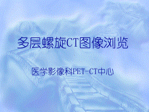 多层螺旋ct图片浏览课件.ppt