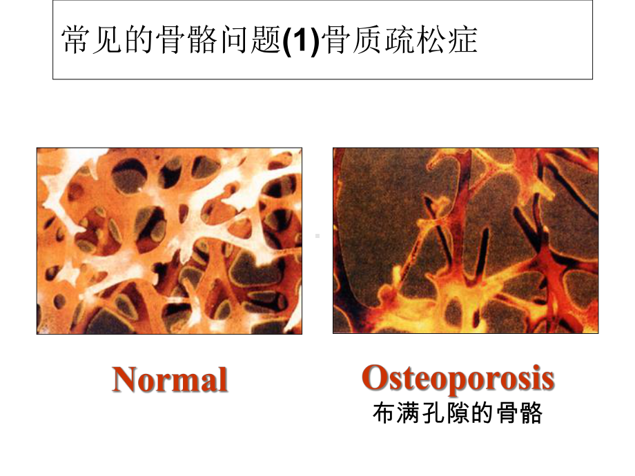 骨骼及眼睛保健课件.ppt_第2页