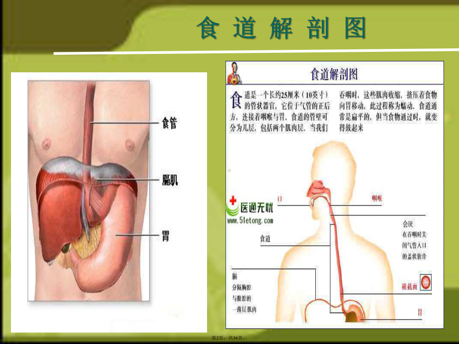 洗胃演示文稿(详细分析“洗胃”共36张)课件.pptx_第2页