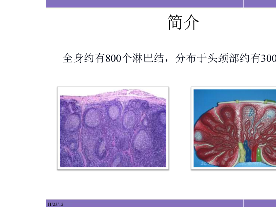 （精品）颈部淋巴结病变影像表现PPT资料.pptx_第2页