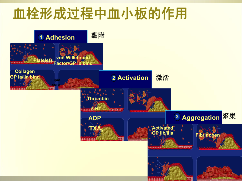 抗血小板治疗与消化道出血对策课件.ppt_第2页