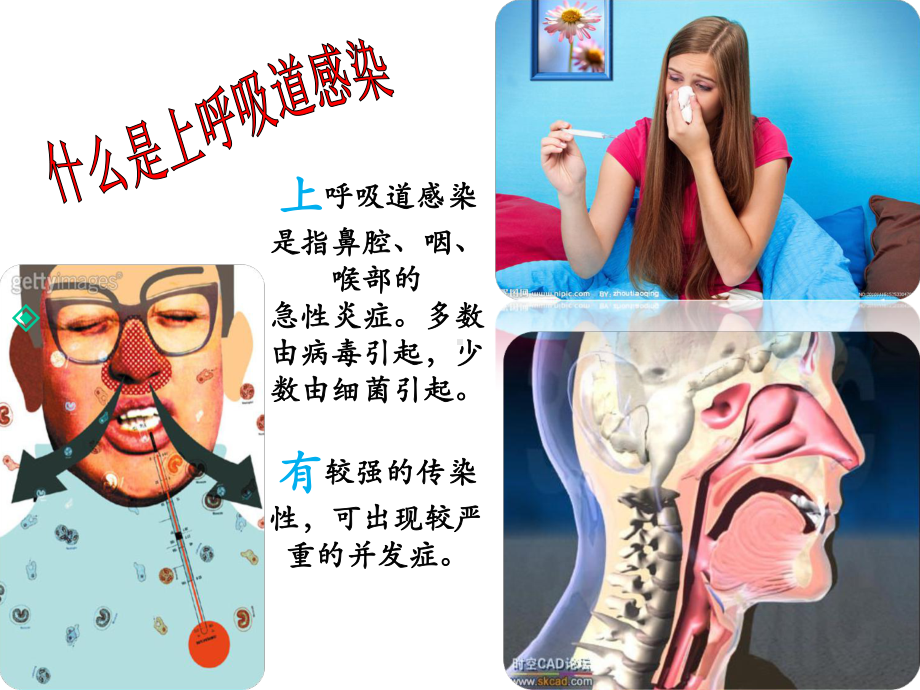 上呼吸道感染的防治.ppt_第2页