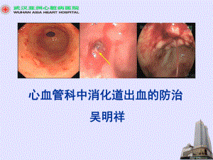 心血管疾病中消化道出血的防治课件医学.ppt