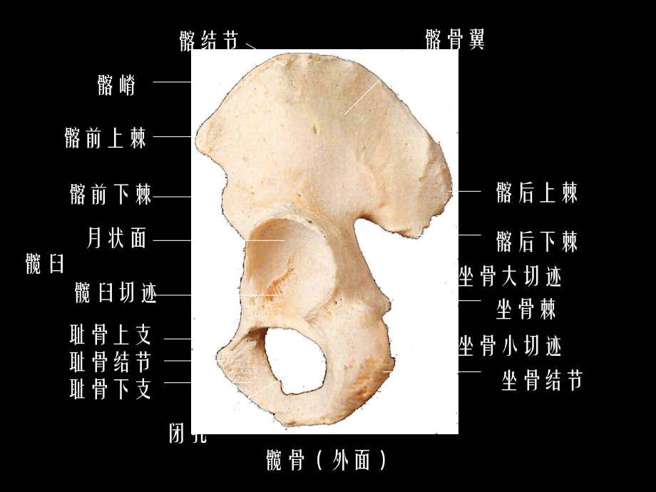 《下肢骨及其连结》课件2.ppt_第3页