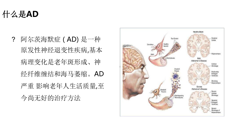 阿尔兹海默症的早期干预医学课件.ppt_第3页