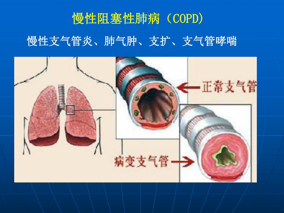 医学精品课件：呼吸1.ppt_第2页