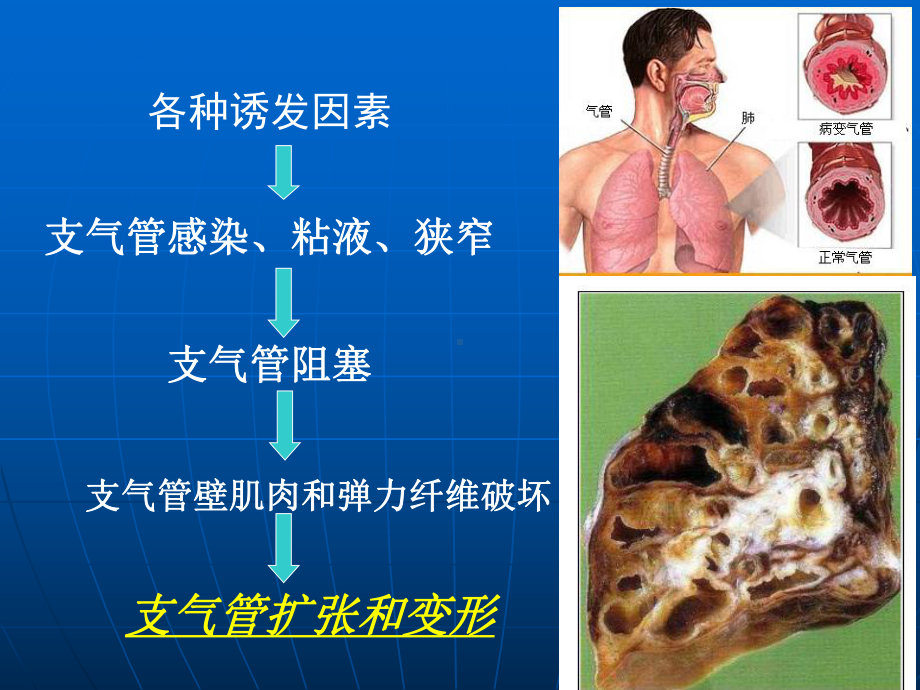 医学精品课件：呼吸1.ppt_第3页