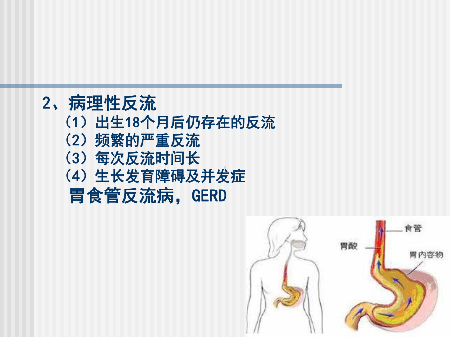 医学精品课件：6胃食管反流.ppt_第3页