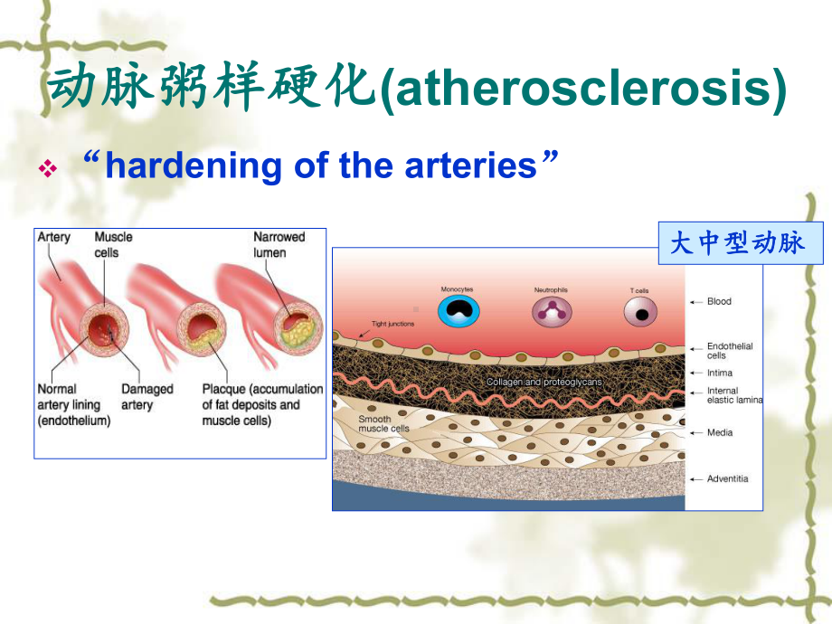 医学精品课件：7 心血管系统疾病.ppt_第2页