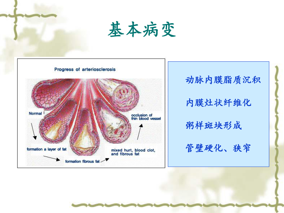 医学精品课件：7 心血管系统疾病.ppt_第3页