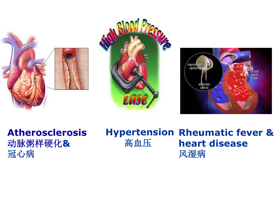 医学精品课件：7.循环.ppt_第2页