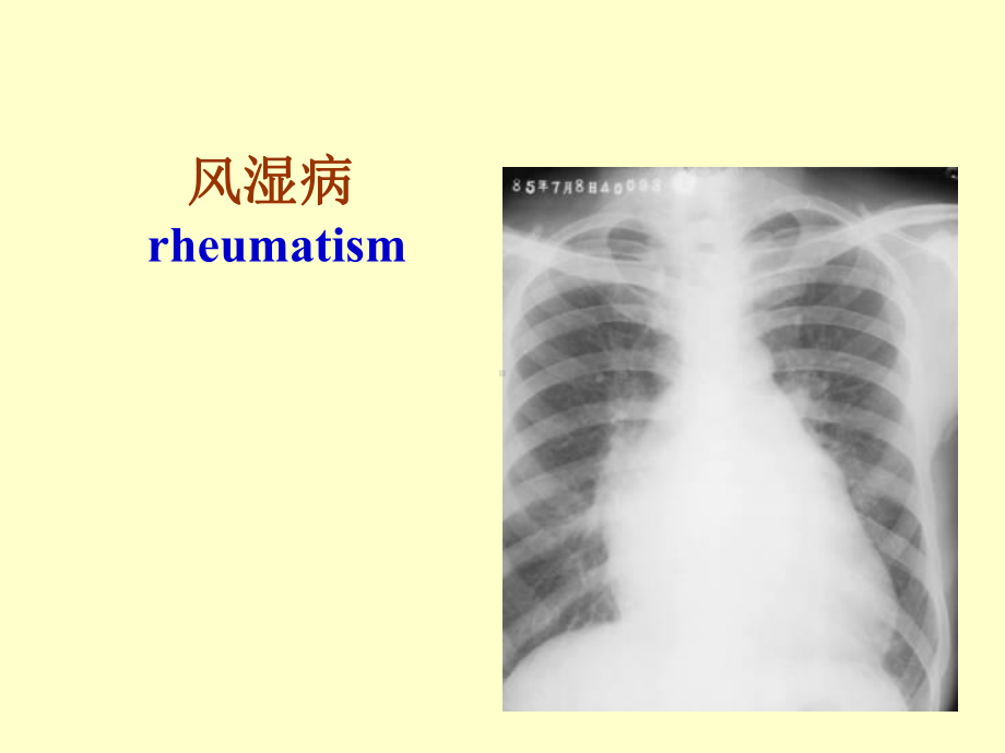 医学精品课件：4.风湿病、心瓣膜病.ppt_第1页