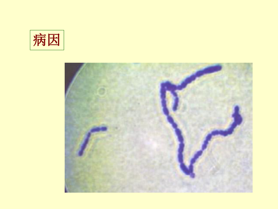 医学精品课件：4.风湿病、心瓣膜病.ppt_第2页