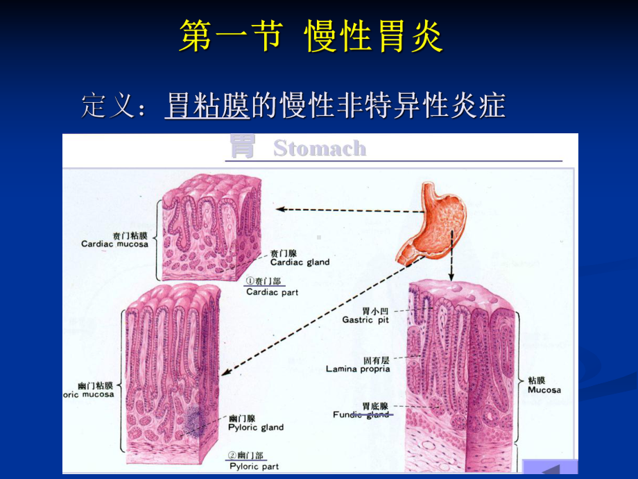 医学精品课件：胃炎、胃溃疡.ppt.ppt_第1页