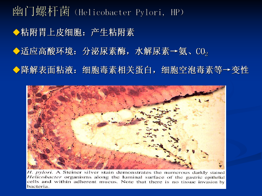 医学精品课件：胃炎、胃溃疡.ppt.ppt_第3页