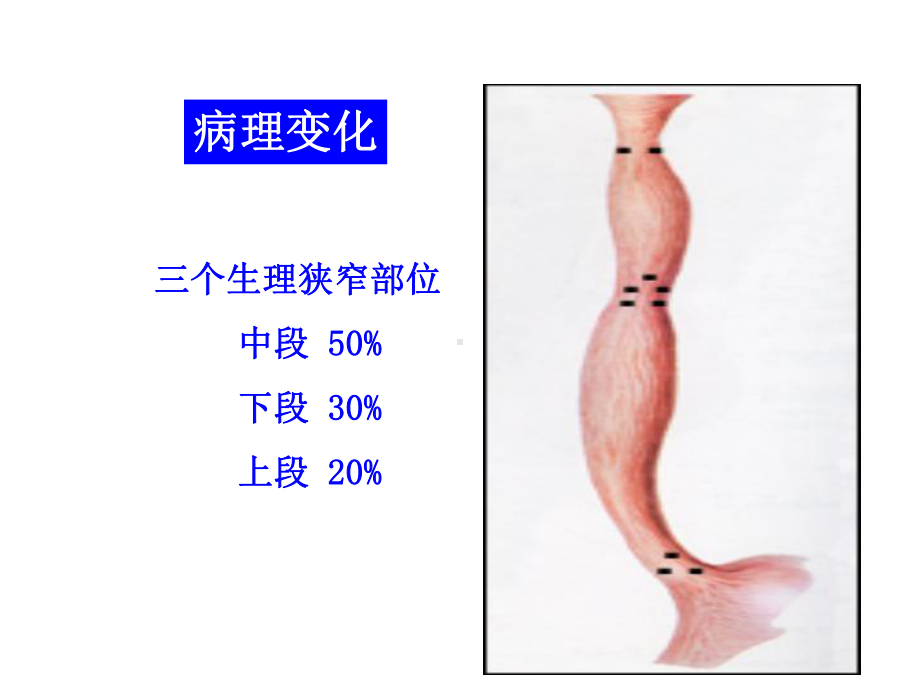 医学精品课件：2.消化肿瘤.ppt_第3页