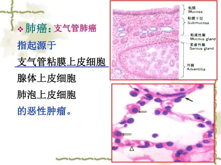 医学精品课件：肺癌课件.ppt_第2页