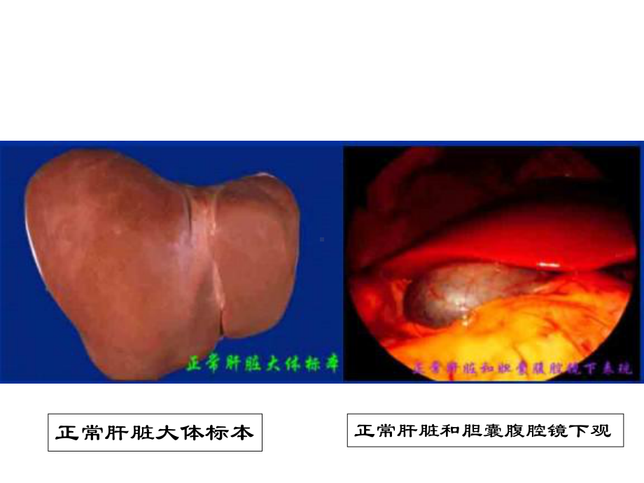 医学精品课件：肝功能不全.ppt_第3页