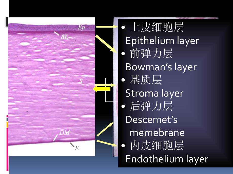 医学精品课件：04角膜病.pptx_第2页