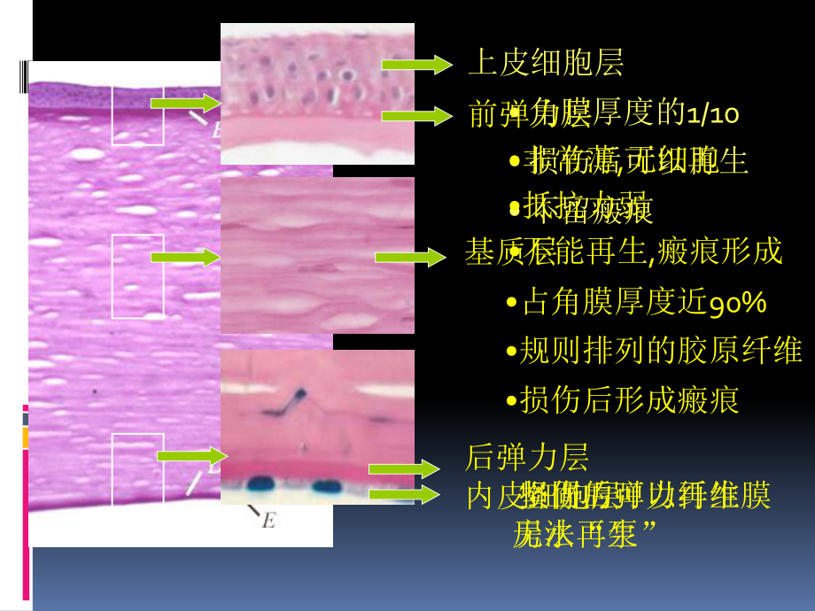 医学精品课件：04角膜病.pptx_第3页