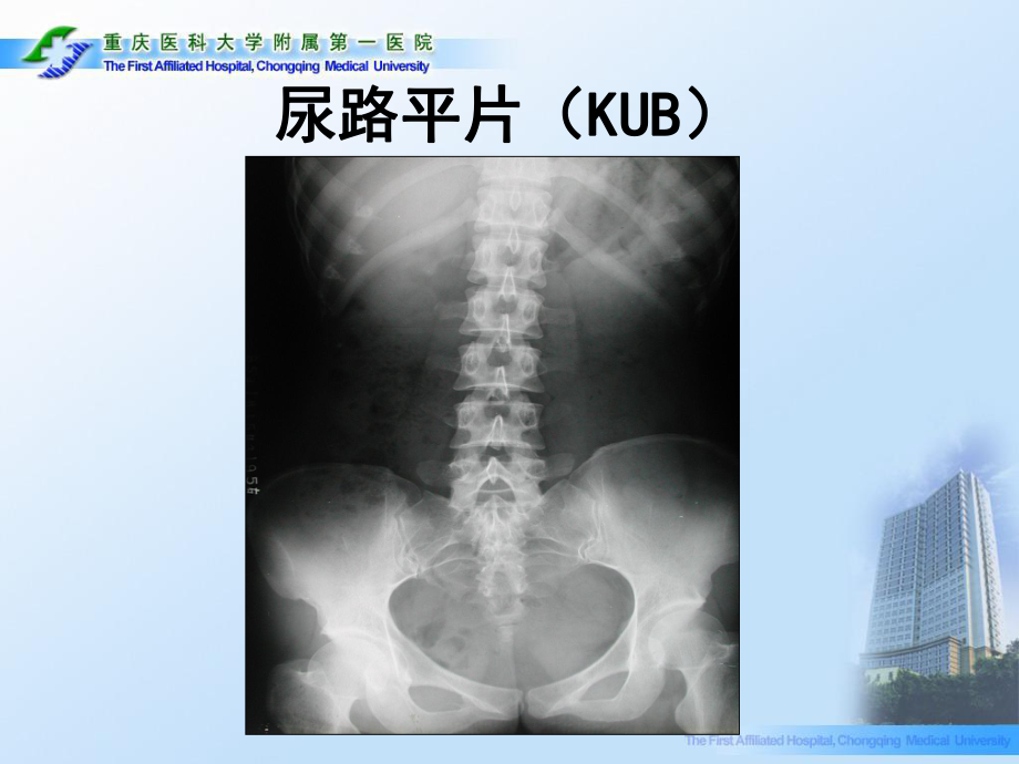 医学精品课件：12.1示教泌尿系统.ppt_第3页