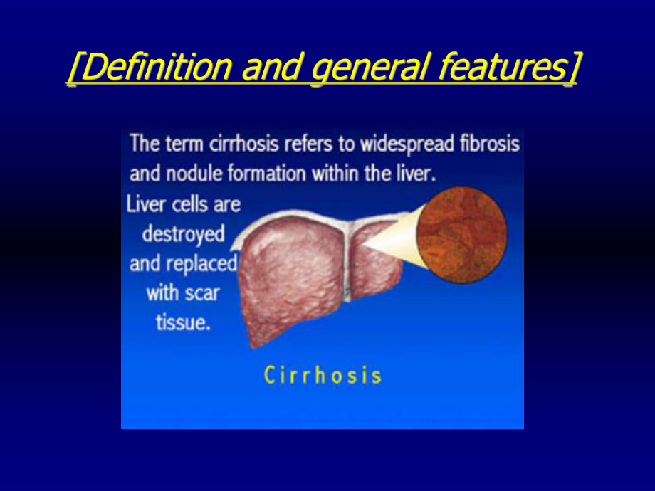 医学精品课件：14.肝硬化.ppt_第3页