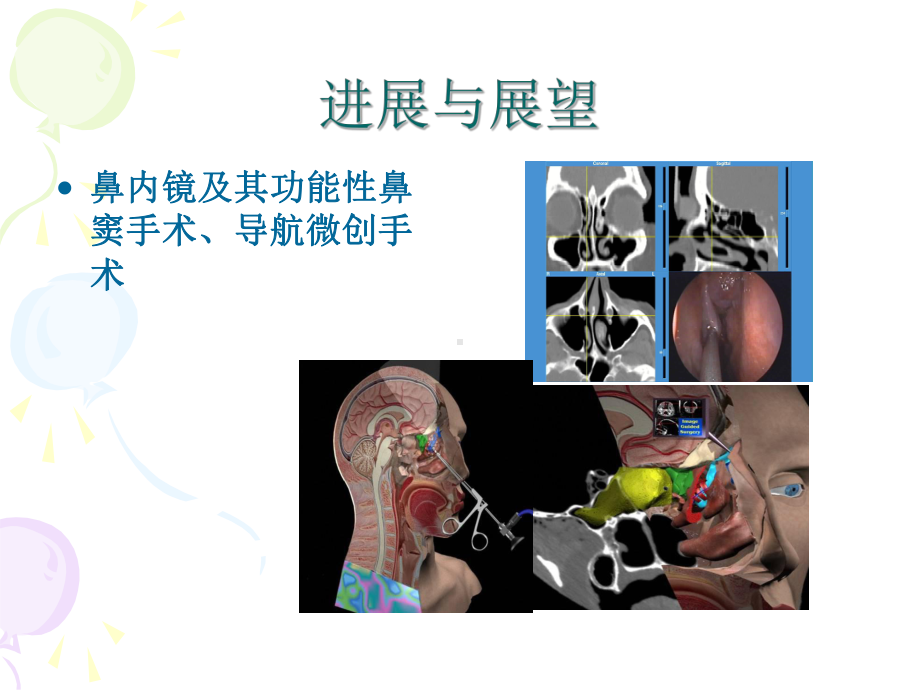 医学精品课件：11（耳鼻喉）2016 鼻1临床.ppt_第3页