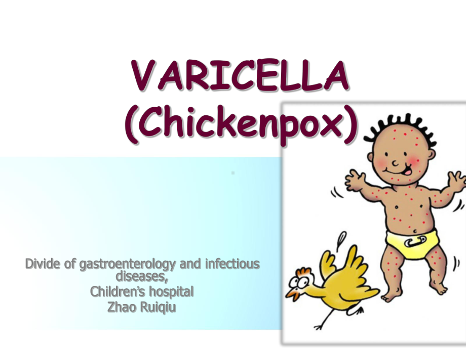 医学精品课件：13.chickenpox-2017.ppt_第1页