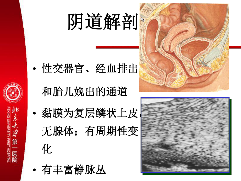 医学精品课件：（10）女性生殖系统炎症.ppt_第3页