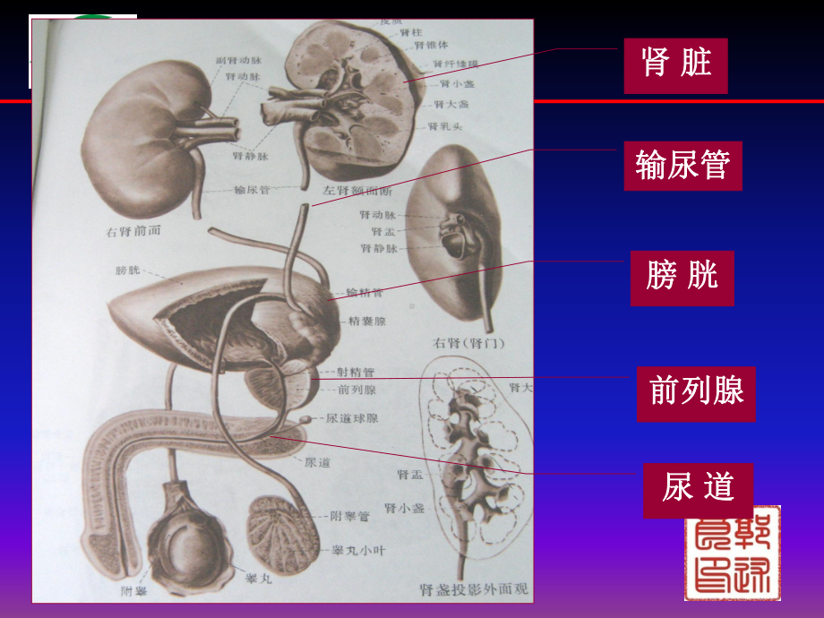 医学精品课件：13.3泌尿系统疾病超声诊断1课时.pptx_第3页