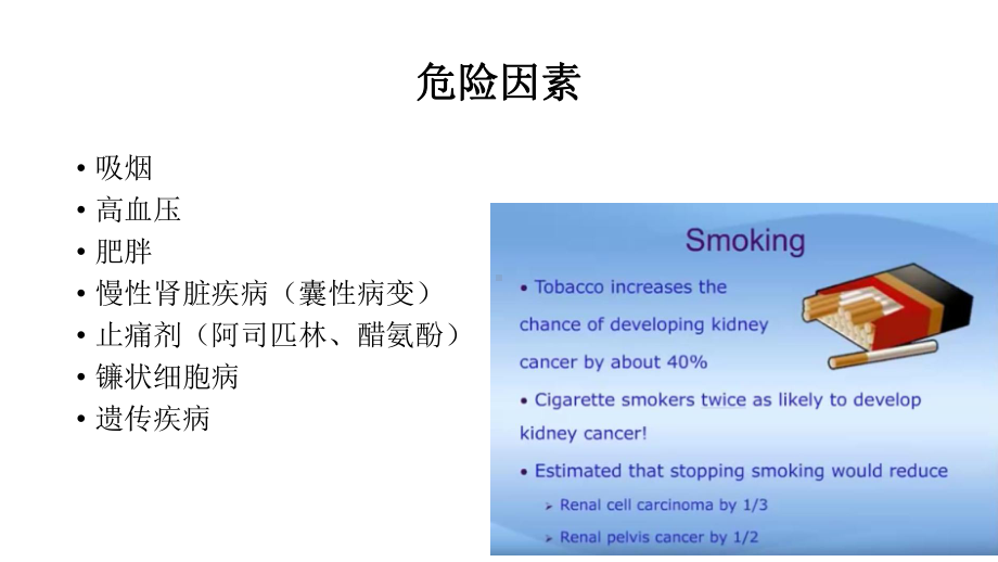 医学精品课件：14.1肾癌.pptx_第3页