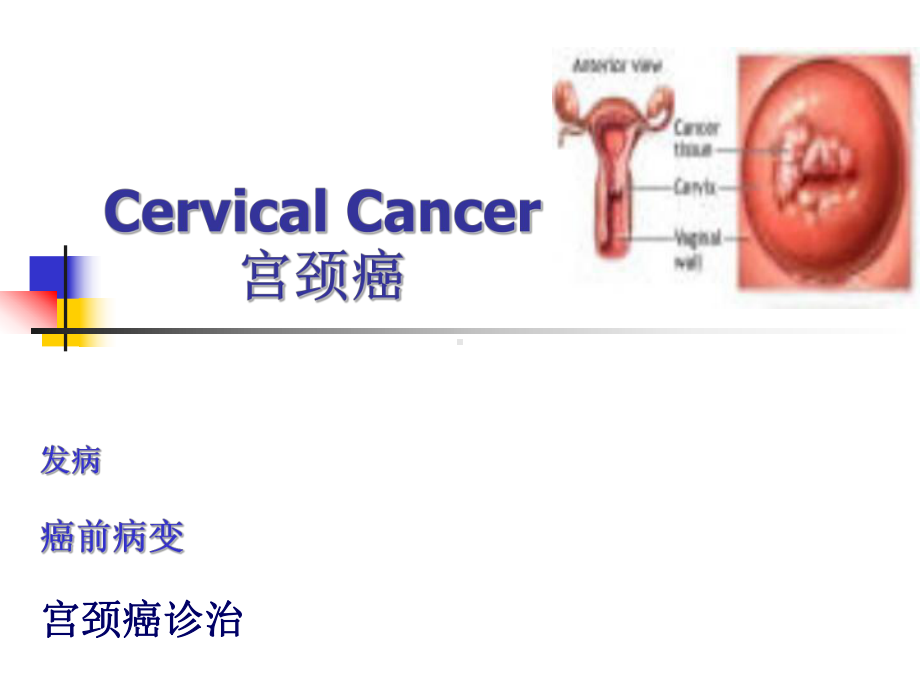 医学精品课件：（12）子宫颈癌.pptx_第1页