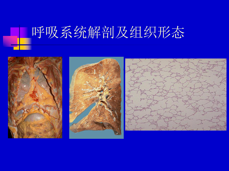 医学精品课件：06.机械性窒息.ppt_第3页