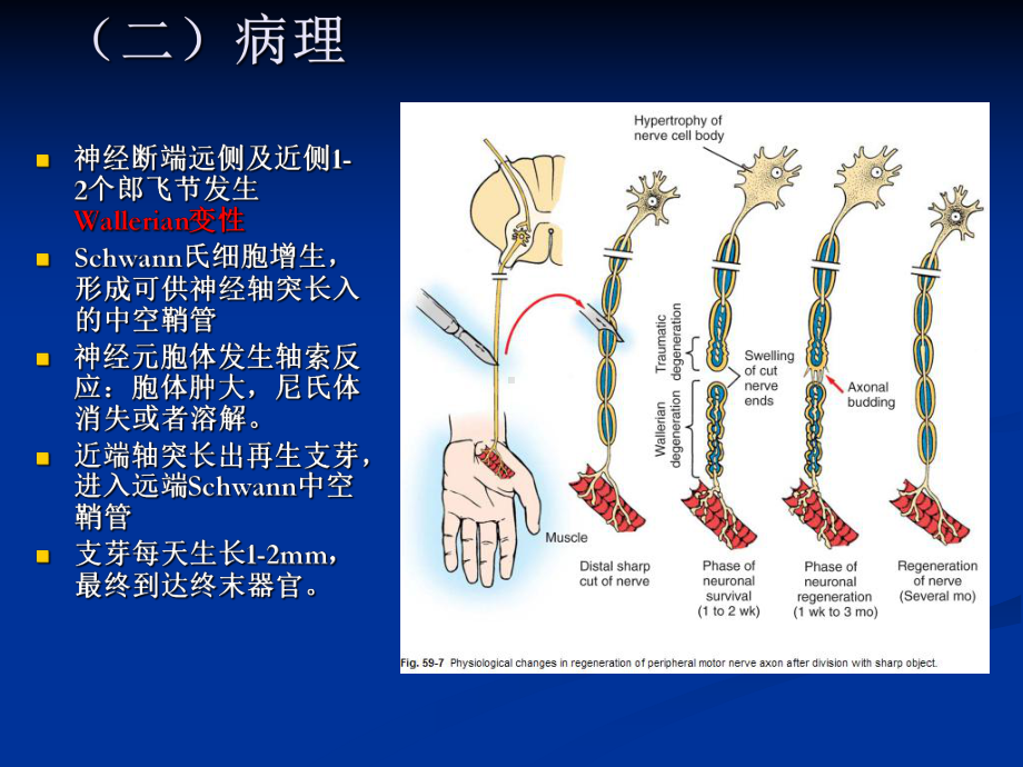 医学精品课件：05.周围神经损伤.ppt_第3页