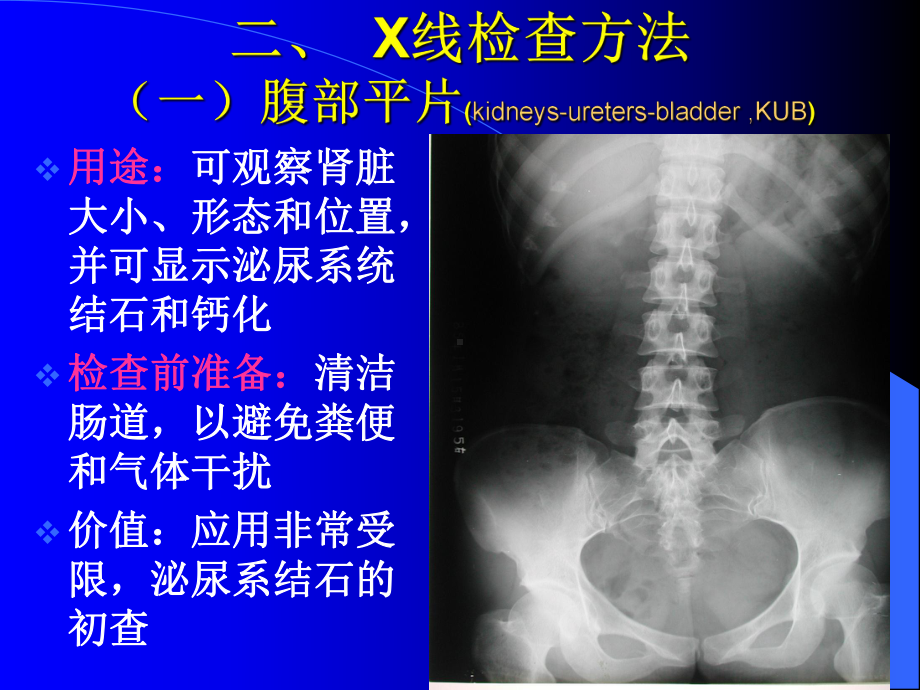 医学精品课件：10.1泌尿系统（祖彬修改后）.ppt_第3页