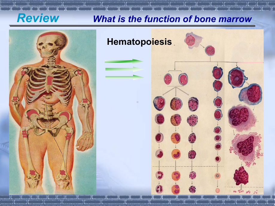 医学精品课件：05.2aplastic anemia-Li Wang.ppt_第2页