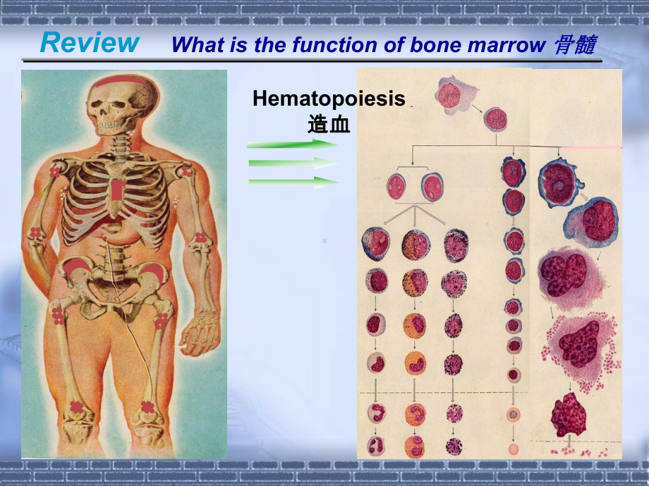 医学精品课件：（参考翻译）05.2aplastic anemia-Li Wang.ppt_第2页