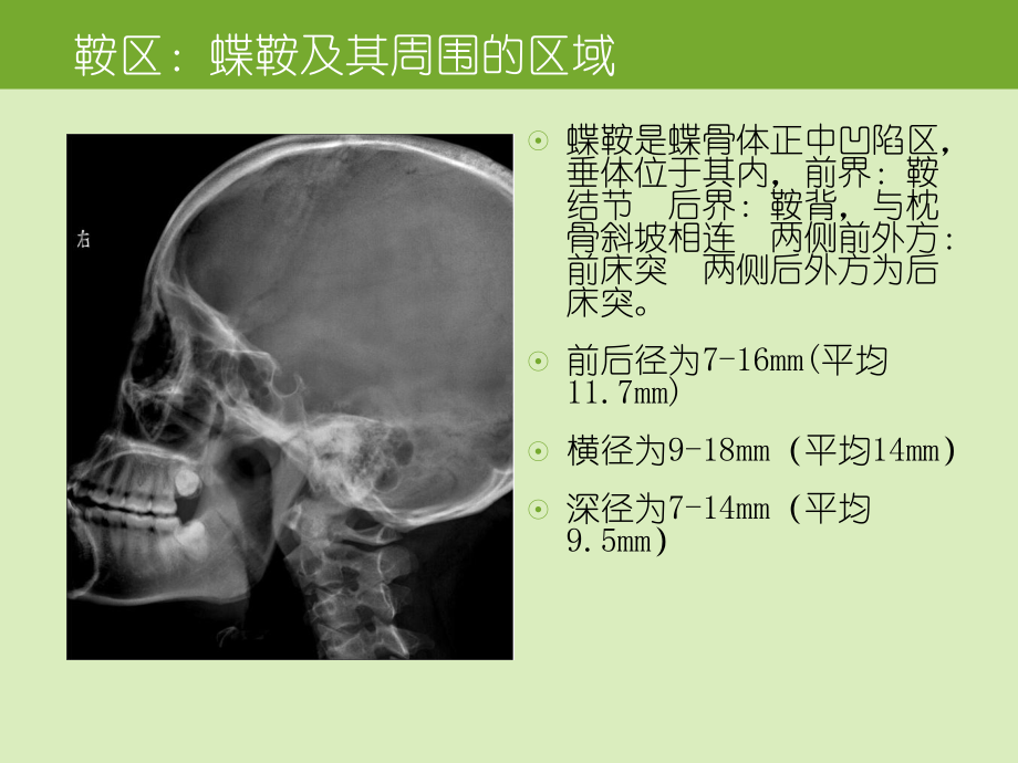 医学精品课件：鞍区肿瘤的影像诊断与鉴别诊断.ppt_第2页