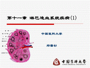 医学精品课件：第十一章 淋巴造血系统疾病.ppt