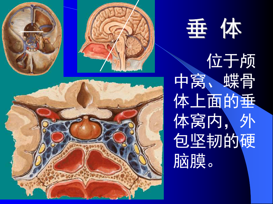 医学精品课件：垂体瘤zhf.ppt_第3页