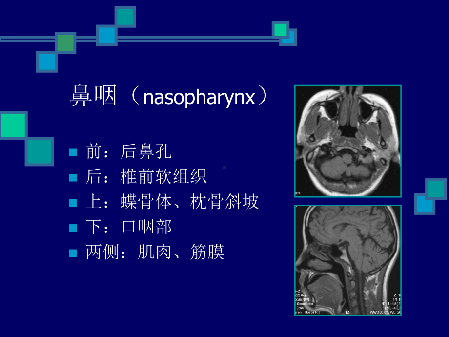 医学精品课件：鼻咽与咽旁间隙影像解剖.ppt_第3页