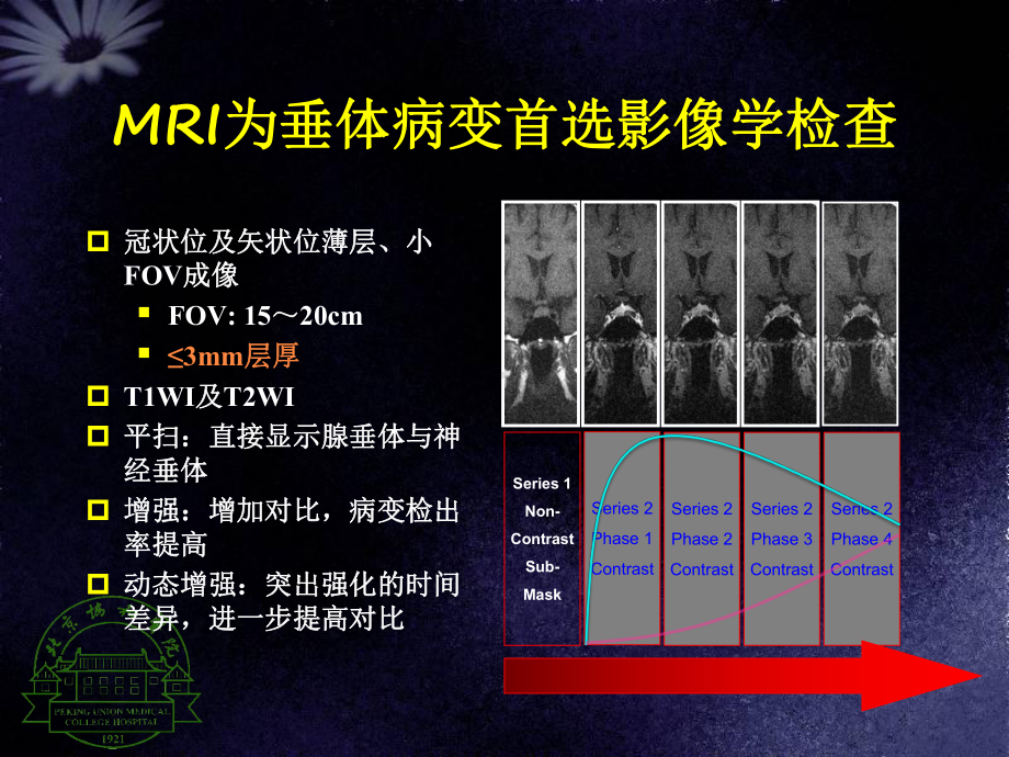 医学精品课件：垂体病变MRI诊断思路.ppt_第2页