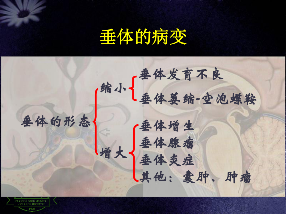 医学精品课件：垂体病变MRI诊断思路.ppt_第3页